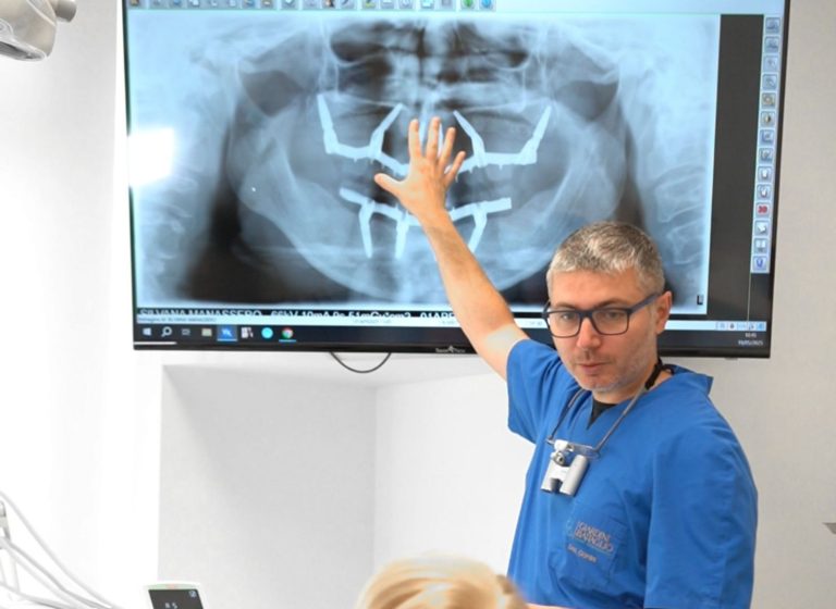 Blog 6 Quanto dura un impianto dentale?